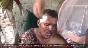 شاهد : تعامل الجيش واللجان مع أحد أسرى المنافقين في موزع بمحافظة تعز (فيديو)