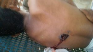 14571850_1294954083851165_1640734380_o