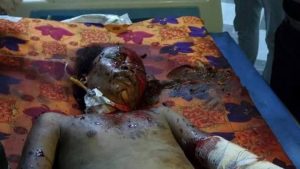 15207892_142693992876129_1717974754_n