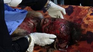 15209135_142694012876127_1712586049_n