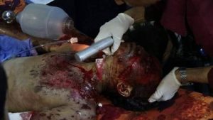 15240317_142694016209460_1839900561_n