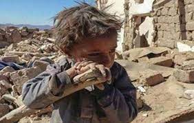 أطفال اليمن عنوان لكل مظلومية تبحث عنها الإنسانية في أروقة الحياة